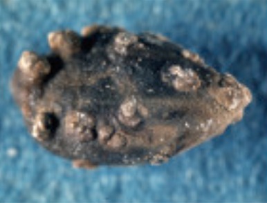 Dark stone with concretions